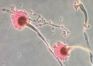 The Silent Spread: How Climate Change Is Fueling a Fungal Health Crisis